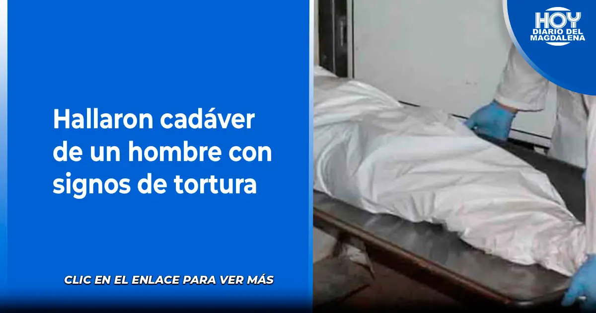 Hallaron Cad Ver De Un Hombre Con Signos De Tortura