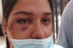 Policia investiga denuncia de mujer presuntamente golpeada por patrullero