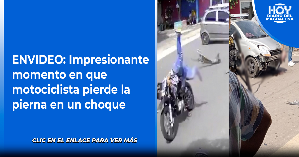 ENVIDEO: Impresionante Momento En Que Motociclista Pierde La Pierna En ...